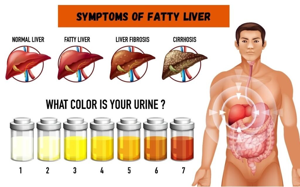 Waspada! Gejala Awal Perlemakan Hati yang Sering Diabaikan