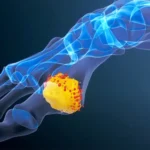 afiapro obat herbal asam urat