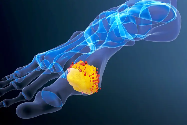 afiapro obat herbal asam urat