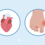 afiapro asam urat dan kolesterol