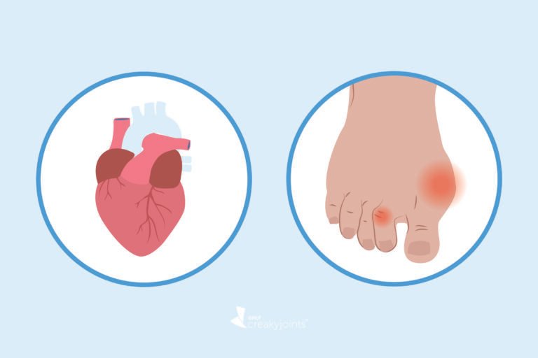 afiapro asam urat dan kolesterol
