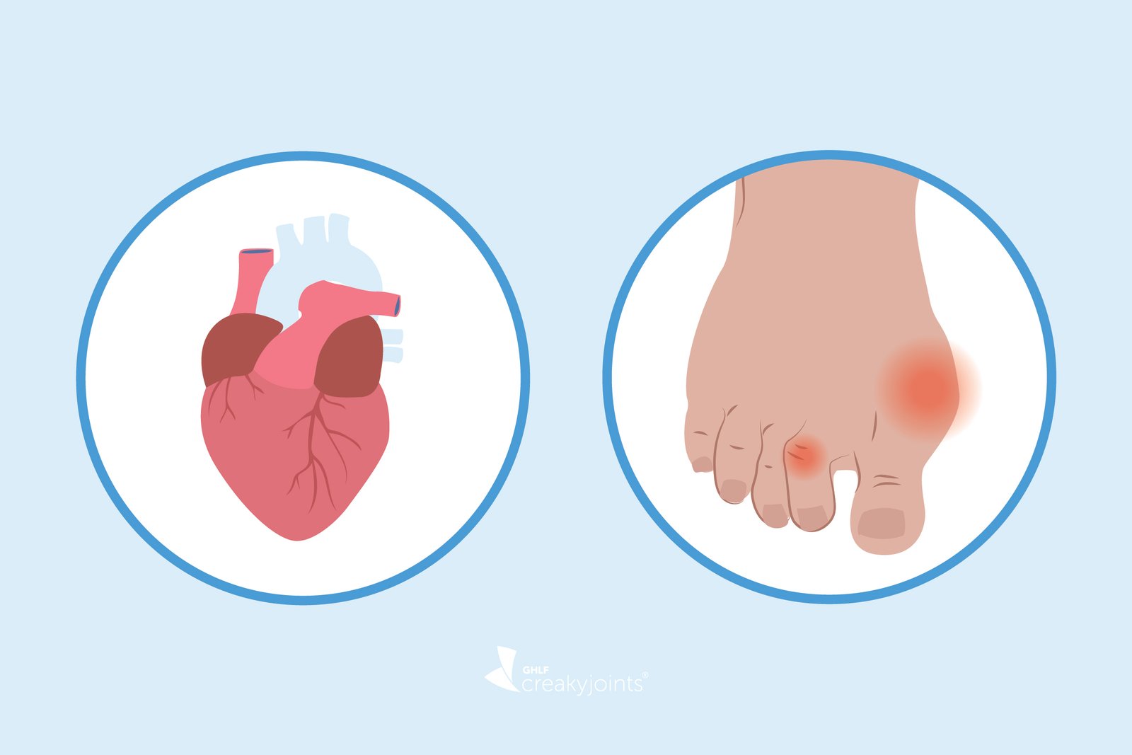 afiapro asam urat dan kolesterol