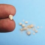 afiapro kristal asam urat tinggi