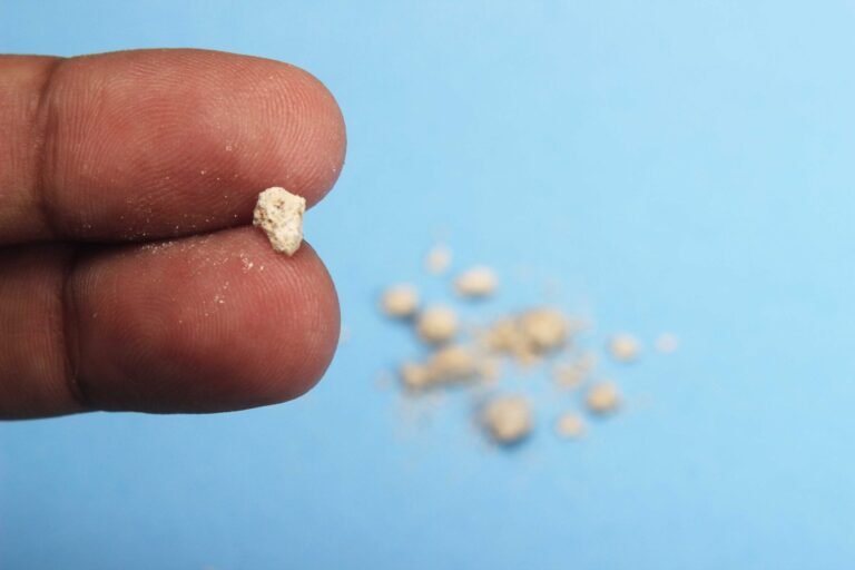 afiapro kristal asam urat tinggi