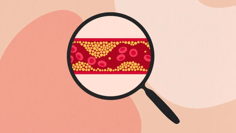 afiapro penyebab kolesterol naik