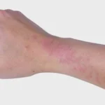 afiapro ciri-ciri diabetes