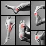 afiapro gejala rasa terbakar