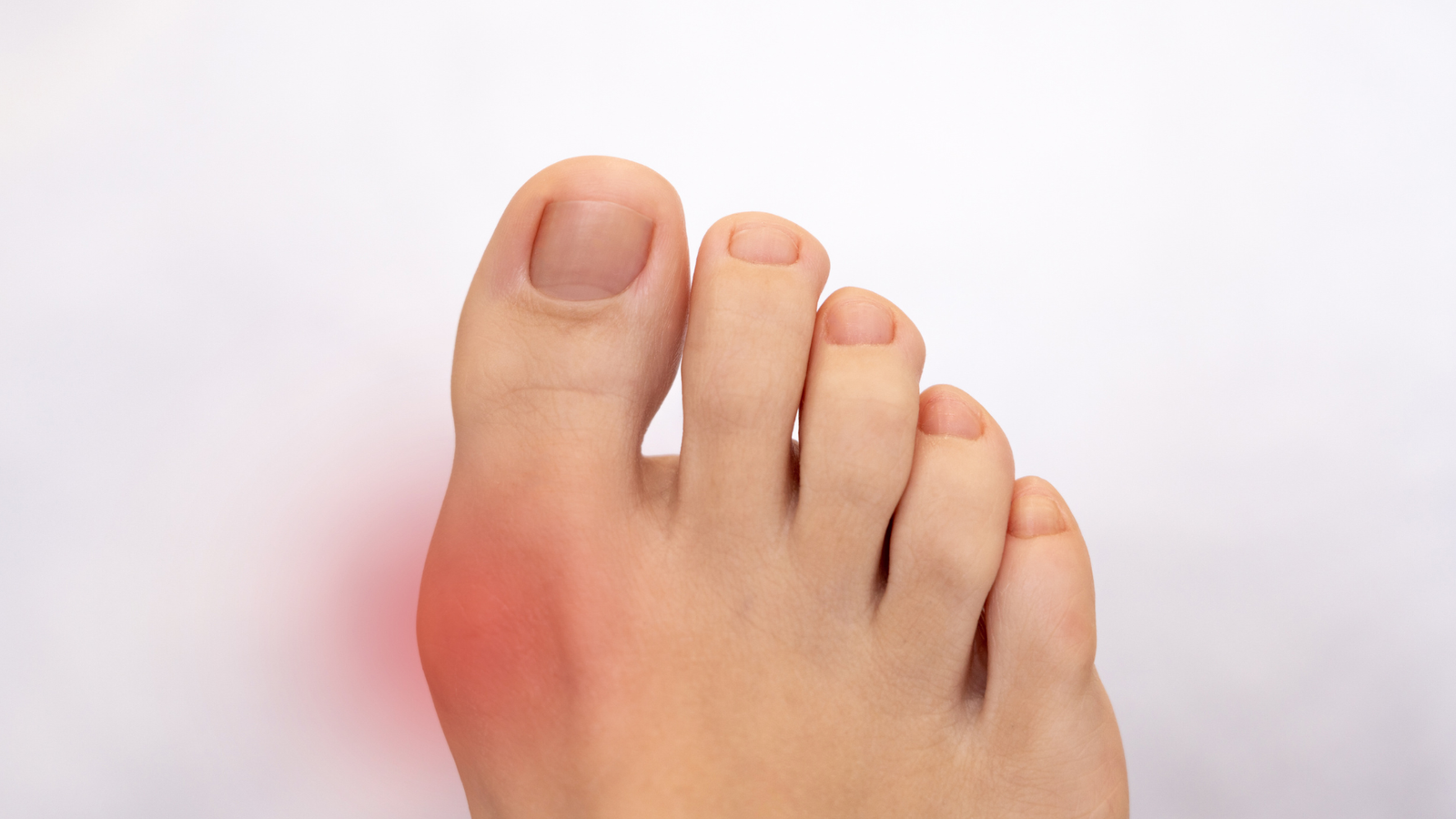 afiapro jempol kaki bengkak