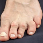 afiapro pertolongan saat sendi bengkak