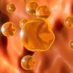 afiapro plak kolesterol