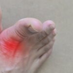 afiapro kristal asam urat