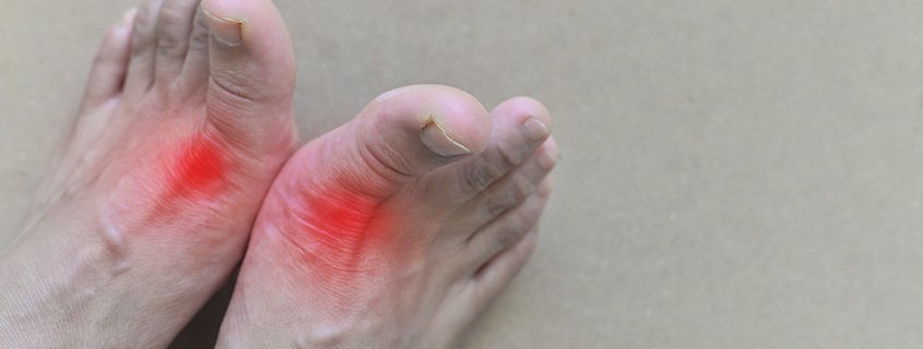 afiapro kristal asam urat