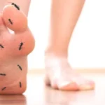 afiapro kesemutan dan pegal leher