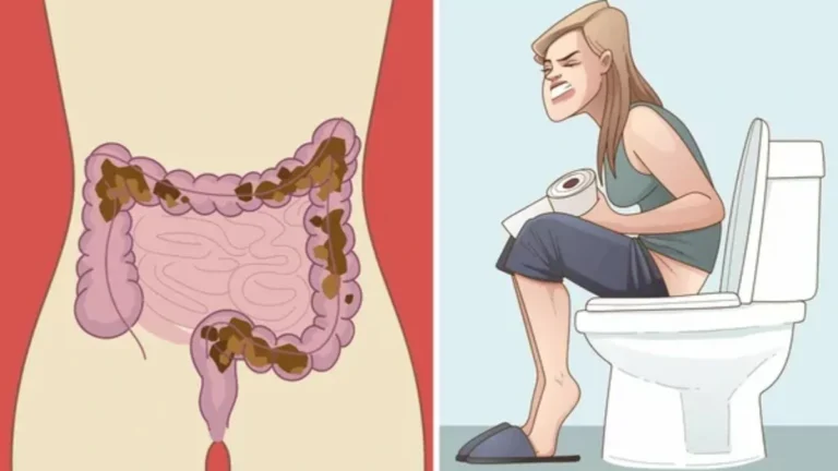 hemotera Sembelit dan BAB Keras