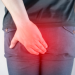 hemotera menghilangkan nyeri dubur