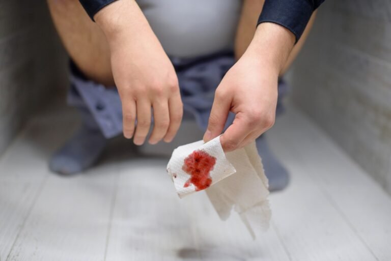 hemotera pendarahan wasir kronis