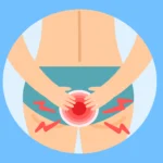 hemotera rasa gatal di dubur