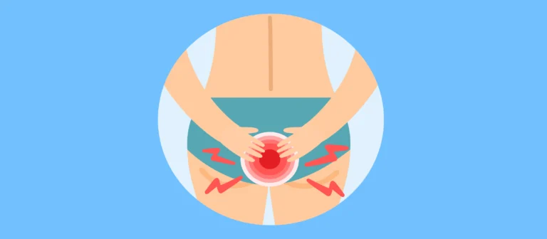 hemotera rasa gatal di dubur