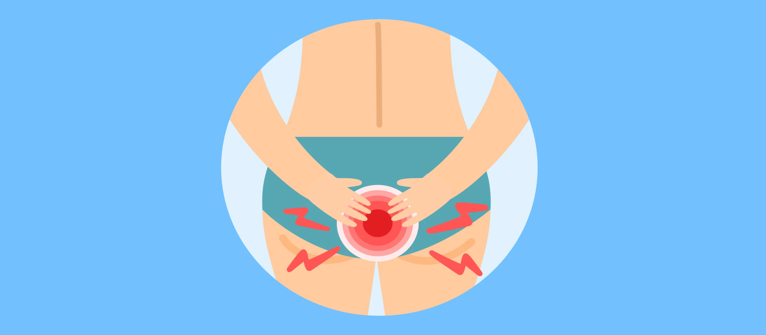 hemotera rasa gatal di dubur