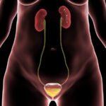 prosterafit berapa lama isk sembuh