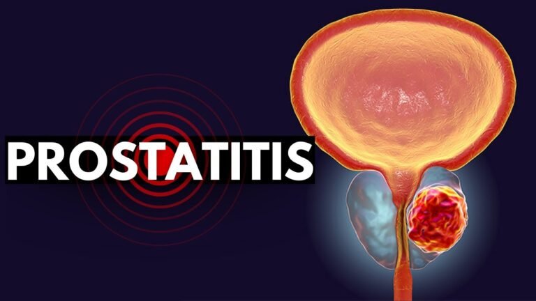 prosterafit cara mengatasi prostatitis kronis
