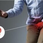 prosterafit cara mengobati radang prostat