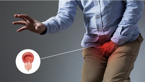 prosterafit cara mengobati radang prostat