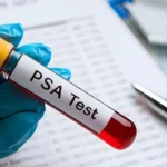 prosterafit fungsi tes darah PSA