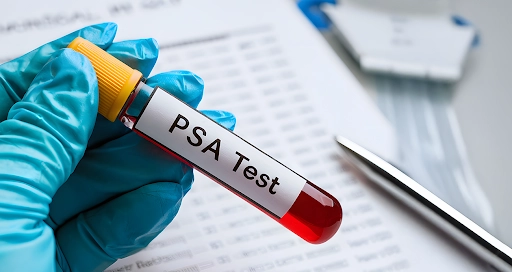 prosterafit fungsi tes darah PSA