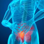 prosterafit radang prostat menjadi kanker