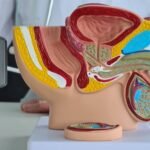 prosterafit mengenal gejala awal prostat