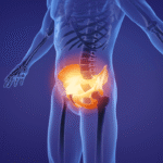 prosterafit penyebab nyeri panggul