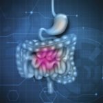 soluma Pemicu kerusakan dinding lambung