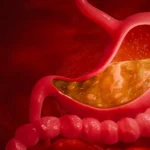 soluma fungsi asam klorida