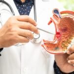 soluma mendiagnosis gangguan asam lambung