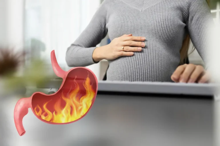 soluma gejala maag saat hamil