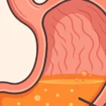 soluma kesehatan lambung