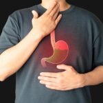 soluma asam lambung naik ke dada