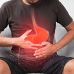 soluma tukak lambung menyebabkan perdarahan