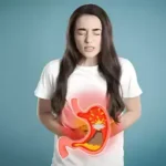 soluma katup lambung yang melemah