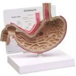 soluma anatomi lambung