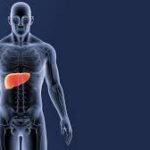 Gejala Fatty Liver yang Sering Dianggap Masalah Biasa