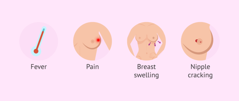 Infeksi Payudara yang Harus Diketahui Semua Wanita