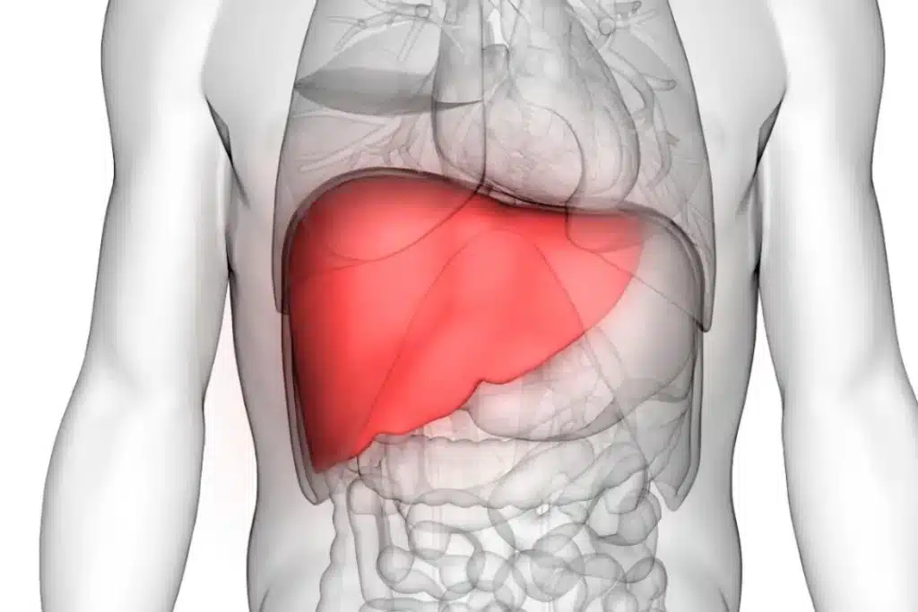 Pengobatan Fatty Liver tanpa Harus Bergantung Obat Kimia