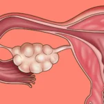 Pentingnya Menjaga Kesehatan Reproduksi Wanita Sebelum Hamil