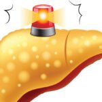 Tanda-Tanda Organ Hati Anda Membutuhkan Perhatian Ekstra