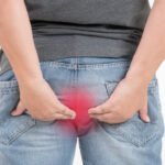 hemotera cara mengempiskan wasir