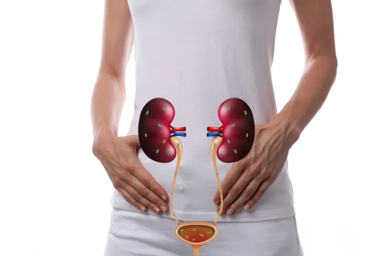 prosterafit mencegah isk berulang