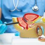 prosterafit memicu masalah prostat