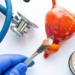 prosterafit prostatitis kronis